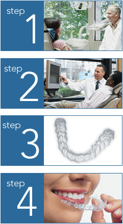 Invisalign Steps