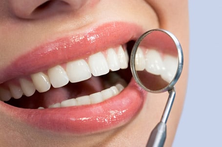 Dental implants restorations